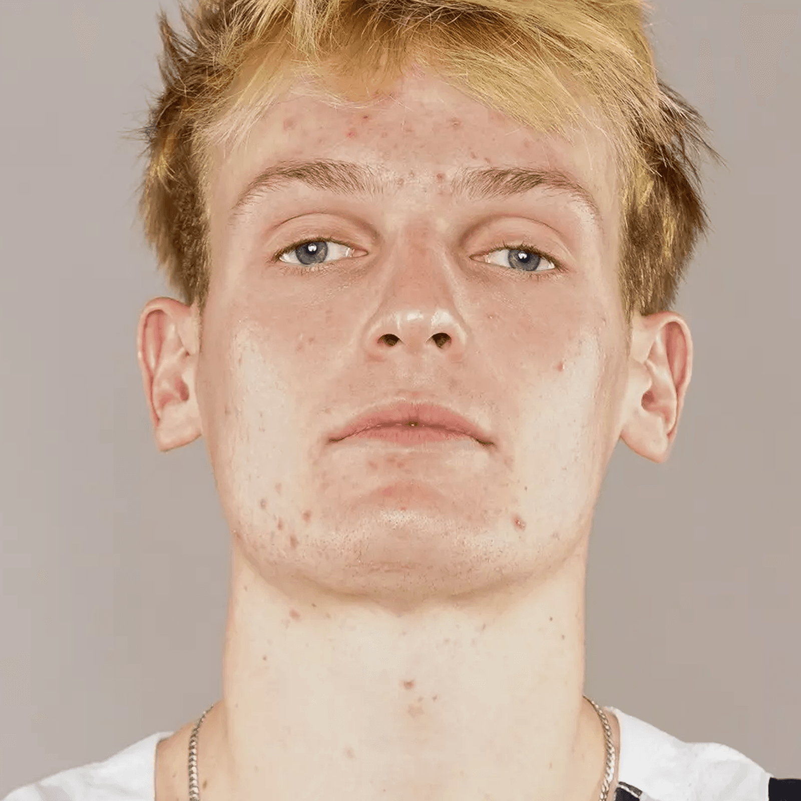 Andrew BALL