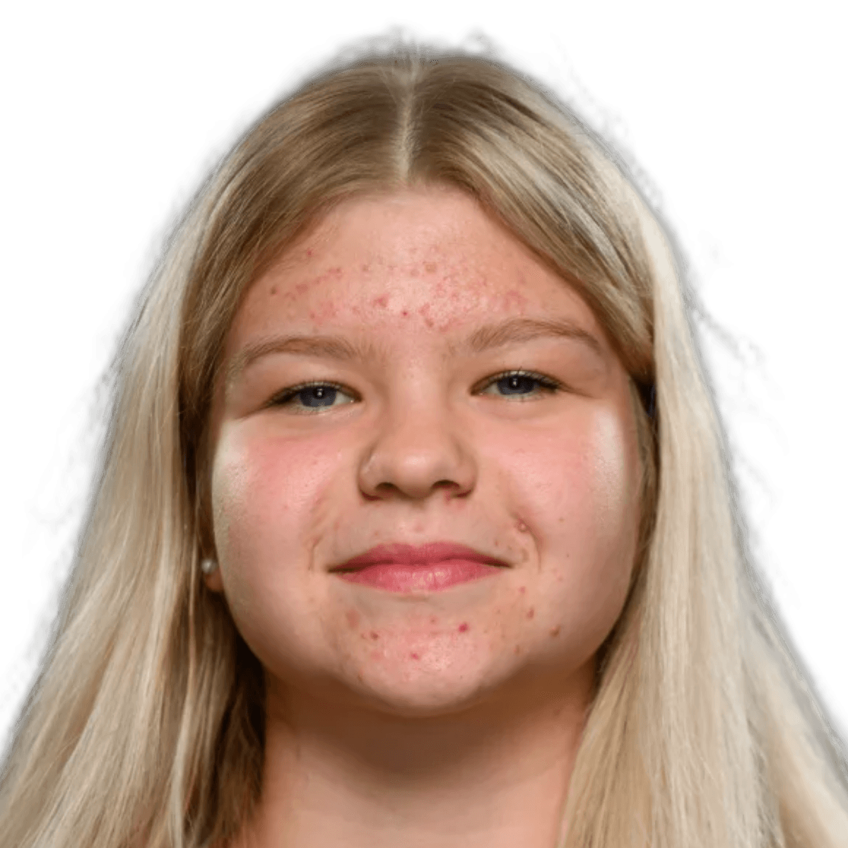 Enija BROKANE